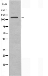 EIF5B / IF2 Antibody - Western blot analysis of extracts of HepG2 cells using EIF5B antibody.