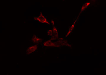 EIF5B / IF2 Antibody - Staining HeLa cells by IF/ICC. The samples were fixed with PFA and permeabilized in 0.1% Triton X-100, then blocked in 10% serum for 45 min at 25°C. The primary antibody was diluted at 1:200 and incubated with the sample for 1 hour at 37°C. An Alexa Fluor 594 conjugated goat anti-rabbit IgG (H+L) antibody, diluted at 1/600, was used as secondary antibody.