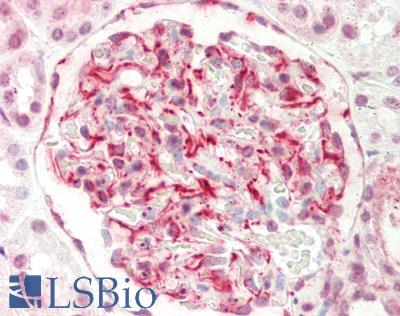 EIF6 Antibody - Human Kidney: Formalin-Fixed, Paraffin-Embedded (FFPE).  This image was taken for the unconjugated form of this product. Other forms have not been tested.