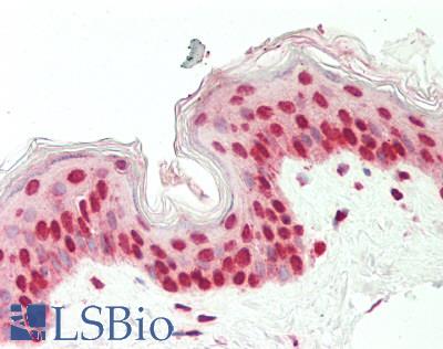 EIF6 Antibody - Human Skin: Formalin-Fixed, Paraffin-Embedded (FFPE).  This image was taken for the unconjugated form of this product. Other forms have not been tested.