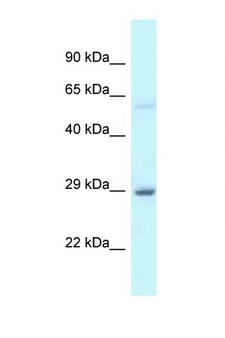 EIF6 Antibody - EIF6 / ITGB4BP antibody western blot of Human Fetal Liver lysate. Antibody concentration 1 ug/ml.  This image was taken for the unconjugated form of this product. Other forms have not been tested.