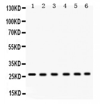 EIF6 Antibody - EIF6 antibody Western blot. All lanes: Anti EIF6 at 0.5 ug/ml. Lane 1: Rat Cardiac Muscle Tissue Lysate at 50 ug. Lane 2: Rat Liver Tissue Lysate at 50 ug. Lane 3: Mouse Liver Tissue Lysate at 50 ug. Lane 4: Human Placenta Tissue Lysate at 50 ug. Lane 5: COLO320 Whole Cell Lysate at 40 ug. Lane 6: HELA Whole Cell Lysate at 40 ug. Predicted band size: 27 kD. Observed band size: 27 kD.