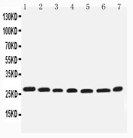EIF6 Antibody - WB of EIF6 antibody. Lane 1: Rat Liver Tissue Lysate. Lane 2: Rat Kidney Tissue Lysate. Lane 3: COLO320 Cell Lysate. Lane 4: SW620 Cell Lysate. Lane 5: HELA Cell Lysate. Lane 6: 293T Cell Lysate. Lane 7: HEPA Cell Lysate..