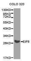 EIF6 Antibody - Western blot of extracts of COLO 320 cell lines, using EIF6 antibody.