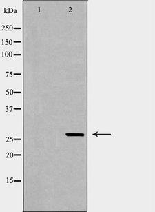 EIF6 Antibody - Western blot analysis of COLO 320 cell lysates using EIF6 antibody. The lane on the left is treated with the antigen-specific peptide.
