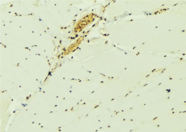 EIF6 Antibody - 1:100 staining mouse muscle tissue by IHC-P. The sample was formaldehyde fixed and a heat mediated antigen retrieval step in citrate buffer was performed. The sample was then blocked and incubated with the antibody for 1.5 hours at 22°C. An HRP conjugated goat anti-rabbit antibody was used as the secondary.