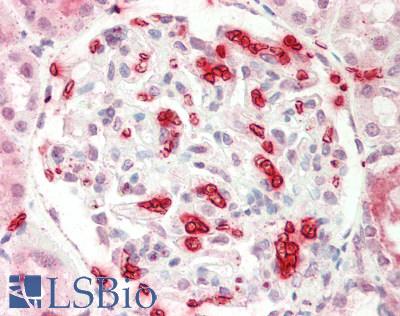 EIF6 Antibody - Human Kidney: Formalin-Fixed, Paraffin-Embedded (FFPE).  This image was taken for the unconjugated form of this product. Other forms have not been tested.