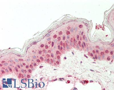 EIF6 Antibody - Human Skin: Formalin-Fixed, Paraffin-Embedded (FFPE).  This image was taken for the unconjugated form of this product. Other forms have not been tested.