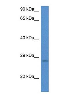EIF6 Antibody - EIF6 / ITGB4BP antibody western blot of HeLa Cell lysate. Antibody concentration 1 ug/ml.  This image was taken for the unconjugated form of this product. Other forms have not been tested.