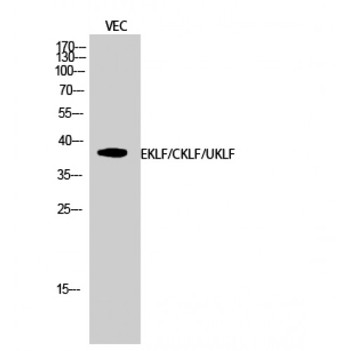 EKLF / KLF1 Antibody - Western blot of EKLF/CKLF/UKLF antibody