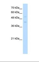 EKLF / KLF1 Antibody - Jurkat cell lysate. Antibody concentration: 0.5 ug/ml. Gel concentration: 12%.  This image was taken for the unconjugated form of this product. Other forms have not been tested.