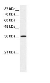 EKLF / KLF1 Antibody - K562 Cell Lysate.  This image was taken for the unconjugated form of this product. Other forms have not been tested.