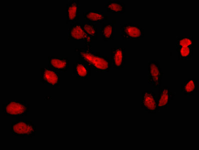 EKLF / KLF1 Antibody - Immunofluorescent analysis of Hela cells using KLF1 Antibody at dilution of 1:100 and Cy3-congugated Goat Anti-Rabbit IgG