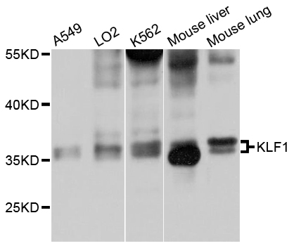 EKLF / KLF1 Antibody - Western blot analysis of extracts of various cell lines.