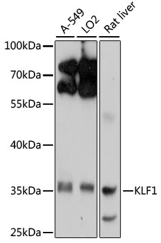 EKLF / KLF1 Antibody - Western blot analysis of extracts of various cell lines, using KLF1 antibody at 1:1000 dilution. The secondary antibody used was an HRP Goat Anti-Rabbit IgG (H+L) at 1:10000 dilution. Lysates were loaded 25ug per lane and 3% nonfat dry milk in TBST was used for blocking. An ECL Kit was used for detection and the exposure time was 30s.