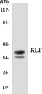 EKLF / KLF1 Antibody - Western blot analysis of the lysates from K562 cells using KLF antibody.