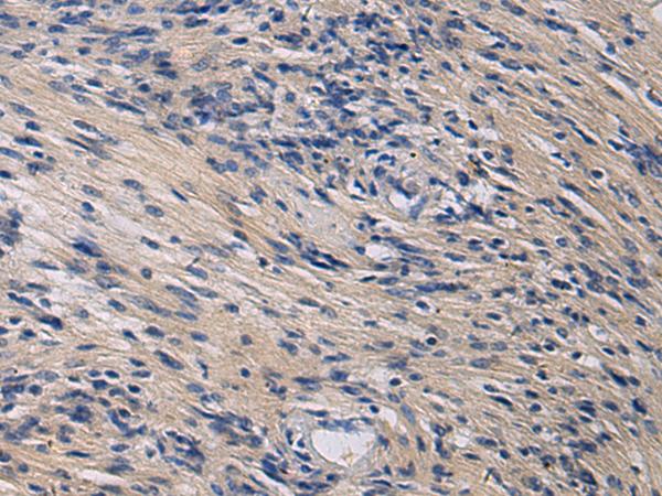 EKLF / KLF1 Antibody - Immunohistochemistry of paraffin-embedded Human brain tissue  using KLF1 Polyclonal Antibody at dilution of 1:35(×200)