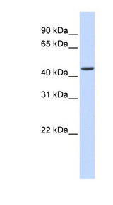 ELAC1 Antibody - ELAC1 antibody Western blot of Fetal Heart lysate. This image was taken for the unconjugated form of this product. Other forms have not been tested.