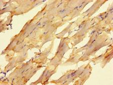 ELAC1 Antibody - Immunohistochemistry of paraffin-embedded human skeletal muscle tissue using ELAC1 Antibody at dilution of 1:100