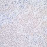 ELAC2 Antibody - Detection of mouse ELAC2 by immunohistochemistry. Sample: FFPE section of mouse plasmacytoma. Antibody: Affinity purified rabbit anti- ELAC2 used at a dilution of 1:1,000 (1µg/ml). Detection: DAB