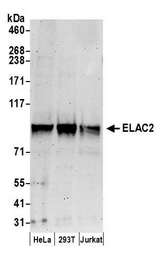 ELAC2 Antibody - Detection of human ELAC2 by western blot. Samples: Whole cell lysate (50 µg) from HeLa, HEK293T, and Jurkat cells prepared using NETN lysis buffer. Antibody: Affinity purified rabbit anti-ELAC2 antibody used for WB at 0.4 µg/ml. Detection: Chemiluminescence with an exposure time of 3 minutes.
