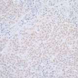 ELAC2 Antibody - Detection of mouse ELAC2 by immunohistochemistry. Sample: FFPE section of mouse plasmacytoma. Antibody: Affinity purified rabbit anti- ELAC2 used at a dilution of 1:1,000 (1µg/ml). Detection: DAB