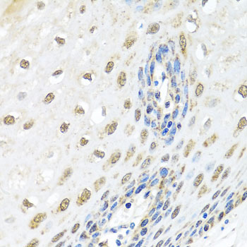 ELAC2 Antibody - Immunohistochemistry of paraffin-embedded human esophagus.