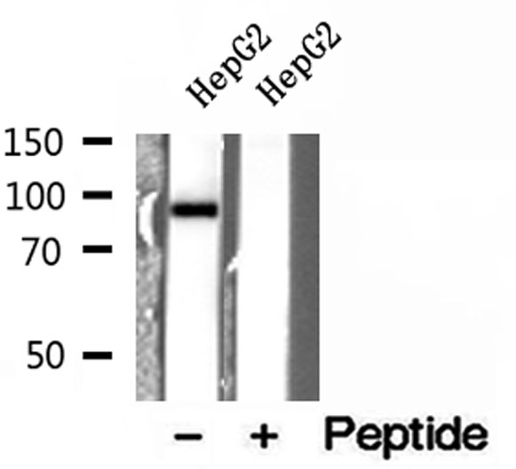 ELAC2 Antibody - Western blot analysis of extracts of HepG2 cells using ELAC2 antibody.