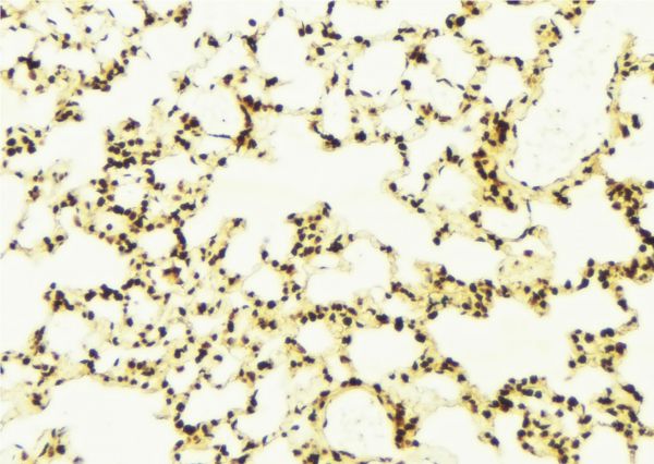 ELAC2 Antibody - 1:100 staining mouse lung tissue by IHC-P. The sample was formaldehyde fixed and a heat mediated antigen retrieval step in citrate buffer was performed. The sample was then blocked and incubated with the antibody for 1.5 hours at 22°C. An HRP conjugated goat anti-rabbit antibody was used as the secondary.