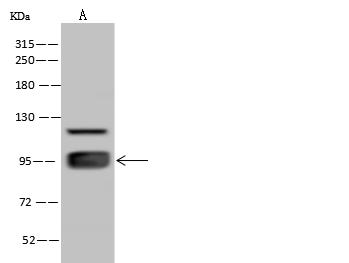 ELAC2 Antibody - Anti-ELAC2 rabbit polyclonal antibody at 1:500 dilution. Lane A: Jurkat Whole Cell Lysate. Lysates/proteins at 30 ug per lane. Secondary: Goat Anti-Rabbit IgG (H+L)/HRP at 1/10000 dilution. Developed using the ECL technique. Performed under reducing conditions. Predicted band size: 92 kDa. Observed band size: 95 kDa.