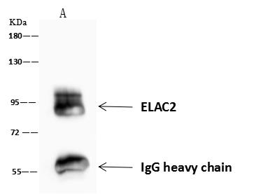 ELAC2 Antibody - ELAC2 was immunoprecipitated using: Lane A: 0.5 mg Jurkat Whole Cell Lysate. 4 uL anti-ELAC2 rabbit polyclonal antibody and 60 ug of Immunomagnetic beads Protein A/G. Primary antibody: Anti-ELAC2 rabbit polyclonal antibody, at 1:100 dilution. Secondary antibody: Goat Anti-Rabbit IgG (H+L)/HRP at 1/10000 dilution. Developed using the ECL technique. Performed under reducing conditions. Predicted band size: 92 kDa. Observed band size: 95 kDa.