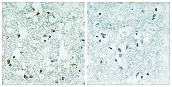 ELAC2 Antibody - Peptide - + Immunohistochemistry analysis of paraffin-embedded human brain tissue, using ELAC2 antibody.
