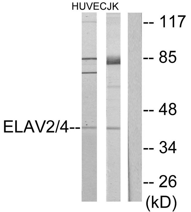 ELAV Like / ELAVL2 + ELAVL4 Antibody - Western blot analysis of lysates from Jurkat and HUVEC cells, using ELAV2/4 Antibody. The lane on the right is blocked with the synthesized peptide.