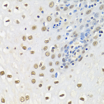 ELAVL1 / HUR Antibody - Immunohistochemistry of paraffin-embedded human esophagus.