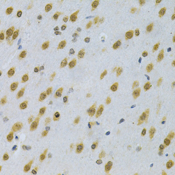 ELAVL1 / HUR Antibody - Immunohistochemistry of paraffin-embedded rat brain using ELAVL1 Antibodyat dilution of 1:200 (40x lens).
