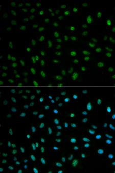 ELAVL1 / HUR Antibody - Immunofluorescence analysis of MCF-7 cells using ELAVL1 antibody. Blue: DAPI for nuclear staining.