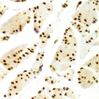 ELAVL1 / HUR Antibody - Immunohistochemistry of paraffin-embedded human esophagus using ELAVL1 Antibodyat dilution of 1:100 (40x lens).