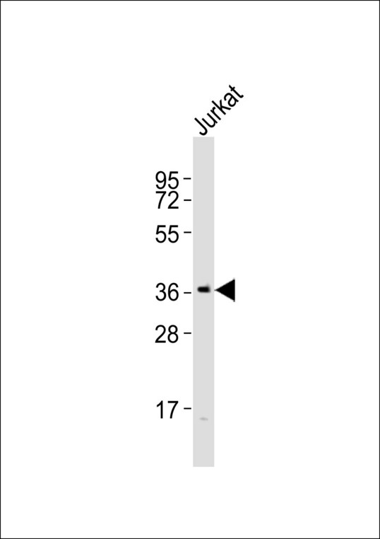 ELAVL1 / HUR Antibody - Anti-HUR Antibody at 1:1000 dilution + Jurkat whole cell lysates Lysates/proteins at 20 ug per lane. Secondary Goat Anti-Rabbit IgG, (H+L),Peroxidase conjugated at 1/10000 dilution Predicted band size : 36 kDa Blocking/Dilution buffer: 5% NFDM/TBST.