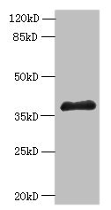 ELAVL1 / HUR Antibody - Western blot All lanes: ELAVL1 antibody at 6µg/ml + A431 whole cell lysate Secondary Goat polyclonal to rabbit IgG at 1/10000 dilution Predicted band size: 37, 39 kDa Observed band size: 37 kDa