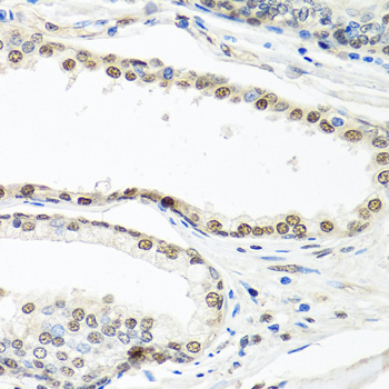 ELAVL1 / HUR Antibody - Immunohistochemistry of paraffin-embedded human prostate using ELAVL1 antibody at dilution of 1:100 (40x lens).