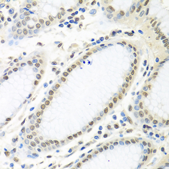 ELAVL1 / HUR Antibody - Immunohistochemistry of paraffin-embedded human stomach using ELAVL1 antibody at dilution of 1:100 (40x lens).
