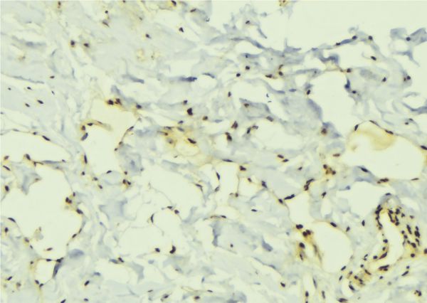 ELAVL1 / HUR Antibody - 1:100 staining mouse muscle tissue by IHC-P. The sample was formaldehyde fixed and a heat mediated antigen retrieval step in citrate buffer was performed. The sample was then blocked and incubated with the antibody for 1.5 hours at 22°C. An HRP conjugated goat anti-rabbit antibody was used as the secondary.