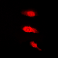 ELAVL2 / HUB Antibody - Immunofluorescent analysis of HuB staining in K562 cells. Formalin-fixed cells were permeabilized with 0.1% Triton X-100 in TBS for 5-10 minutes and blocked with 3% BSA-PBS for 30 minutes at room temperature. Cells were probed with the primary antibody in 3% BSA-PBS and incubated overnight at 4 C in a humidified chamber. Cells were washed with PBST and incubated with a DyLight 594-conjugated secondary antibody (red) in PBS at room temperature in the dark. DAPI was used to stain the cell nuclei (blue).