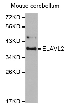 ELAVL2 / HUB Antibody - Western blot analysis of extracts of Mouse cerebellum cell lines, using ELAVL2 antibody. .