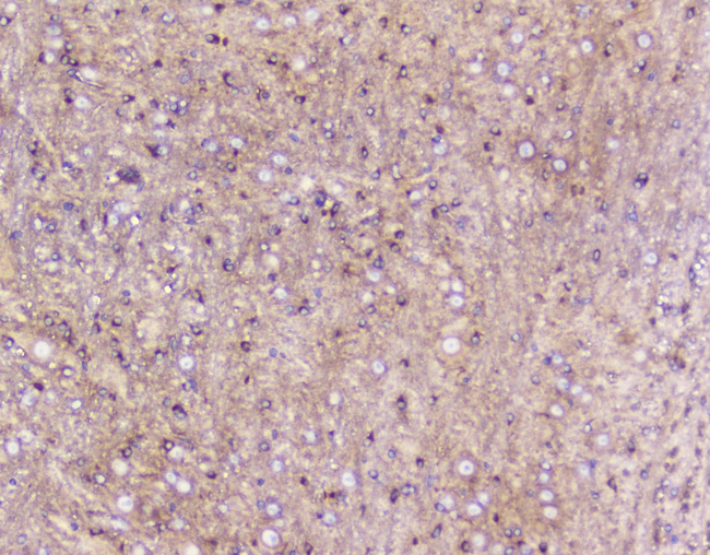 ELAVL2 / HUB Antibody - IHC analysis of ELAVL2 HuB using anti-ELAVL2 HuB antibody. ELAVL2 HuB was detected in paraffin-embedded section of mouse brain tissue. Heat mediated antigen retrieval was performed in citrate buffer (pH6, epitope retrieval solution) for 20 mins. The tissue section was blocked with 10% goat serum. The tissue section was then incubated with 1µg/ml rabbit anti-ELAVL2 HuB Antibody overnight at 4°C. Biotinylated goat anti-rabbit IgG was used as secondary antibody and incubated for 30 minutes at 37°C. The tissue section was developed using Strepavidin-Biotin-Complex (SABC) with DAB as the chromogen.