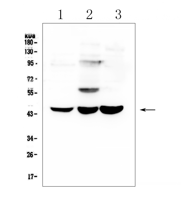 ELAVL2 / HUB Antibody - Western blot analysis of ELAVL2 HuB using anti-ELAVL2 HuB antibody. Electrophoresis was performed on a 5-20% SDS-PAGE gel at 70V (Stacking gel) / 90V (Resolving gel) for 2-3 hours. The sample well of each lane was loaded with 50ug of sample under reducing conditions. Lane 1: human T-47D whole cell lysate,Lane 2: human A549 whole cell lysate,Lane 3: human Caco-2 whole cell lysate. After Electrophoresis, proteins were transferred to a Nitrocellulose membrane at 150mA for 50-90 minutes. Blocked the membrane with 5% Non-fat Milk/ TBS for 1.5 hour at RT. The membrane was incubated with rabbit anti-ELAVL2 HuB antigen affinity purified polyclonal antibody at 0.5 µg/mL overnight at 4°C, then washed with TBS-0.1% Tween 3 times with 5 minutes each and probed with a goat anti-rabbit IgG-HRP secondary antibody at a dilution of 1:10000 for 1.5 hour at RT. The signal is developed using an Enhanced Chemiluminescent detection (ECL) kit with Tanon 5200 system. A specific band was detected for ELAVL2 HuB at approximately 45KD. The expected band size for ELAVL2 HuB is at 40KD.
