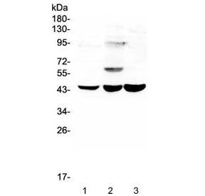 ELAVL2 / HUB Antibody - Western blot testing of human 1) T-47D, 2) A549 and 3) Caco-2 lysate with ELAVL2 antibody at 0.5ug/ml. Predicted molecular weight ~40 kDa.