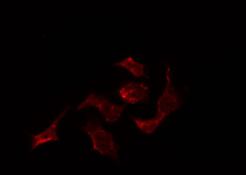 ELAVL2 / HUB Antibody - Staining HepG2 cells by IF/ICC. The samples were fixed with PFA and permeabilized in 0.1% Triton X-100, then blocked in 10% serum for 45 min at 25°C. The primary antibody was diluted at 1:200 and incubated with the sample for 1 hour at 37°C. An Alexa Fluor 594 conjugated goat anti-rabbit IgG (H+L) Ab, diluted at 1/600, was used as the secondary antibody.