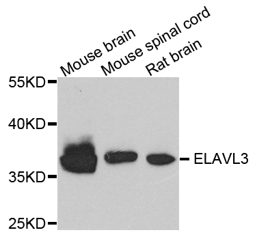 ELAVL3 / HUC Antibody - Western blot analysis of extracts of various cells.