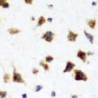 ELAVL3 / HUC Antibody - Immunohistochemical analysis of HuC staining in rat brain formalin fixed paraffin embedded tissue section. The section was pre-treated using heat mediated antigen retrieval with sodium citrate buffer (pH 6.0). The section was then incubated with the antibody at room temperature and detected using an HRP conjugated compact polymer system. DAB was used as the chromogen. The section was then counterstained with hematoxylin and mounted with DPX.